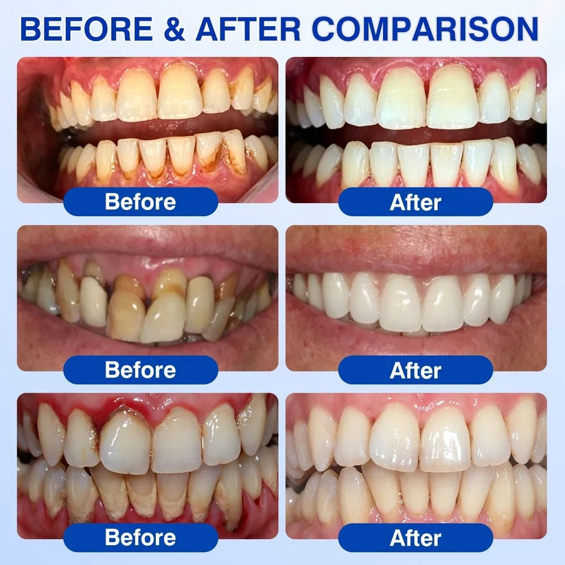 🦷 GumRevive Periodontal Repair Gel