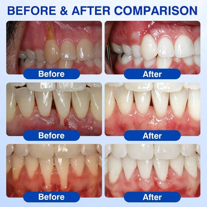 🦷 GumRevive Periodontal Repair Gel