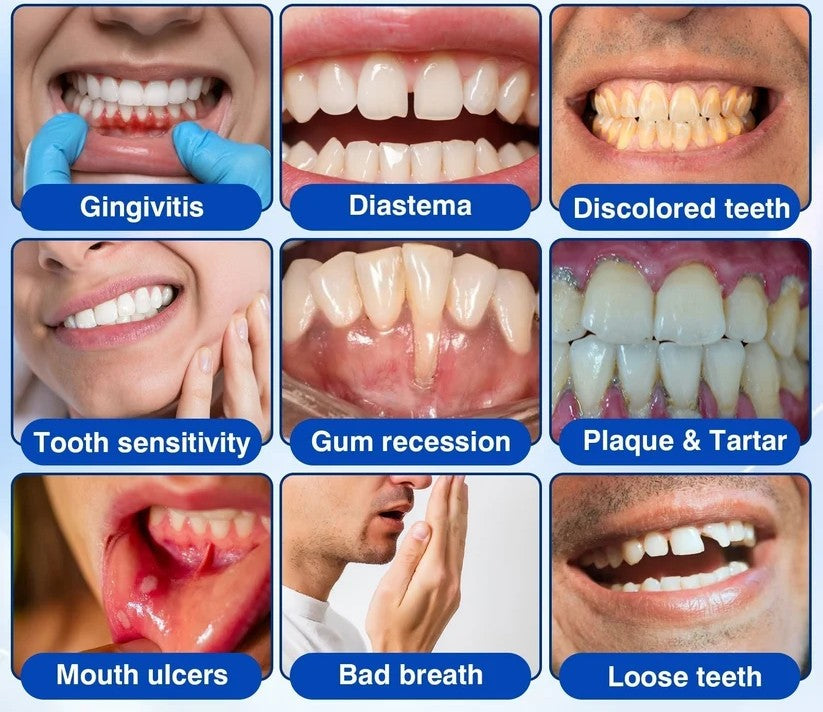 🦷 GumRevive Periodontal Repair Gel