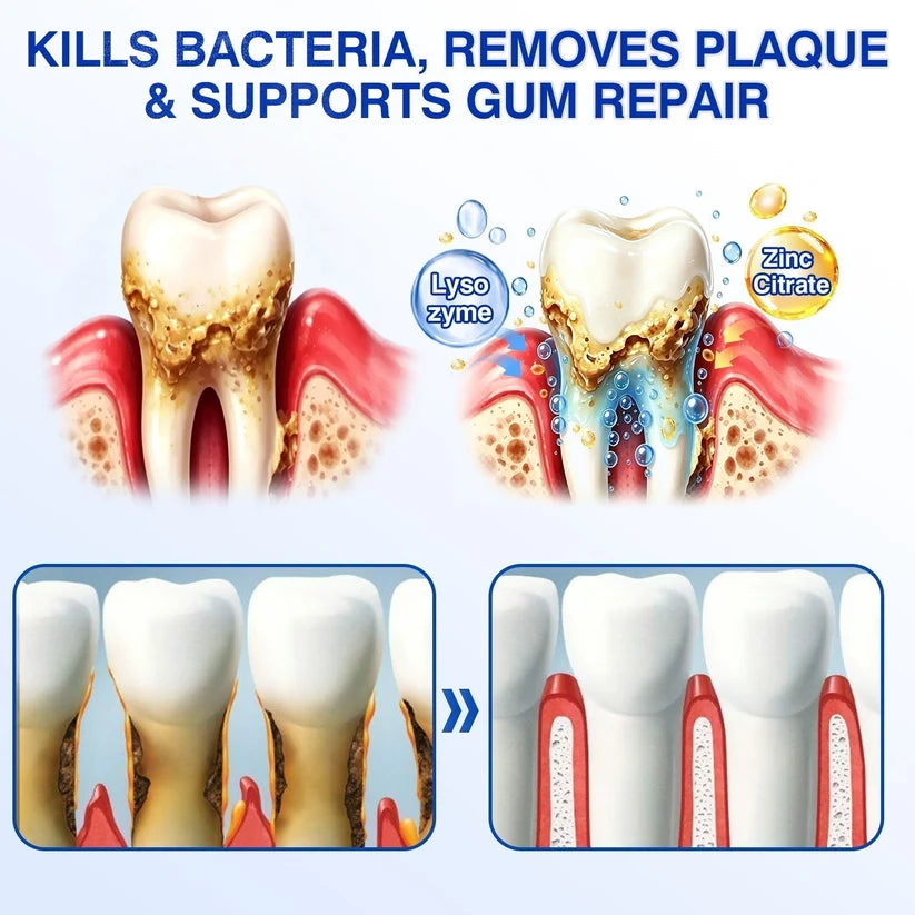 🦷 GumRevive Periodontal Repair Gel