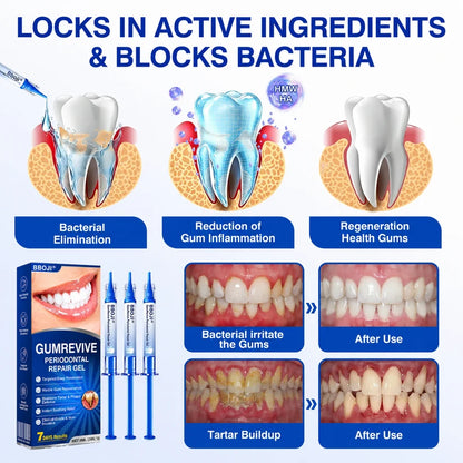 🦷 GumRevive Periodontal Repair Gel
